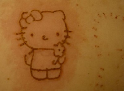 Hello Kitty hot pen brand scar 
