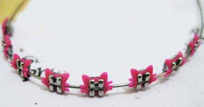 Hello Kitty fashion braces