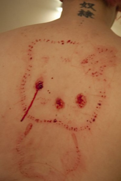 Hello Kitty acupuncture needles scar