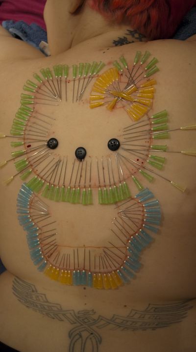 Hello Kitty acupuncture needle artist