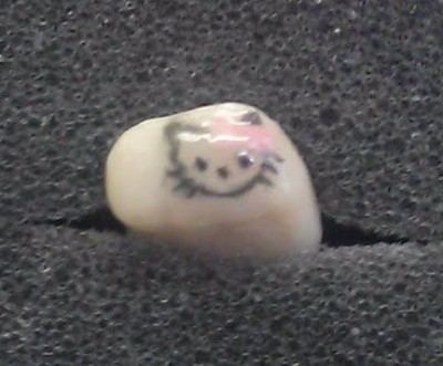 Hello Kitty tooth